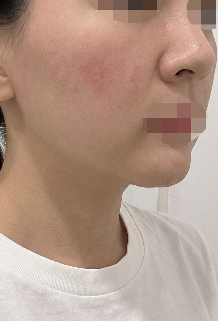 수술후기이미지