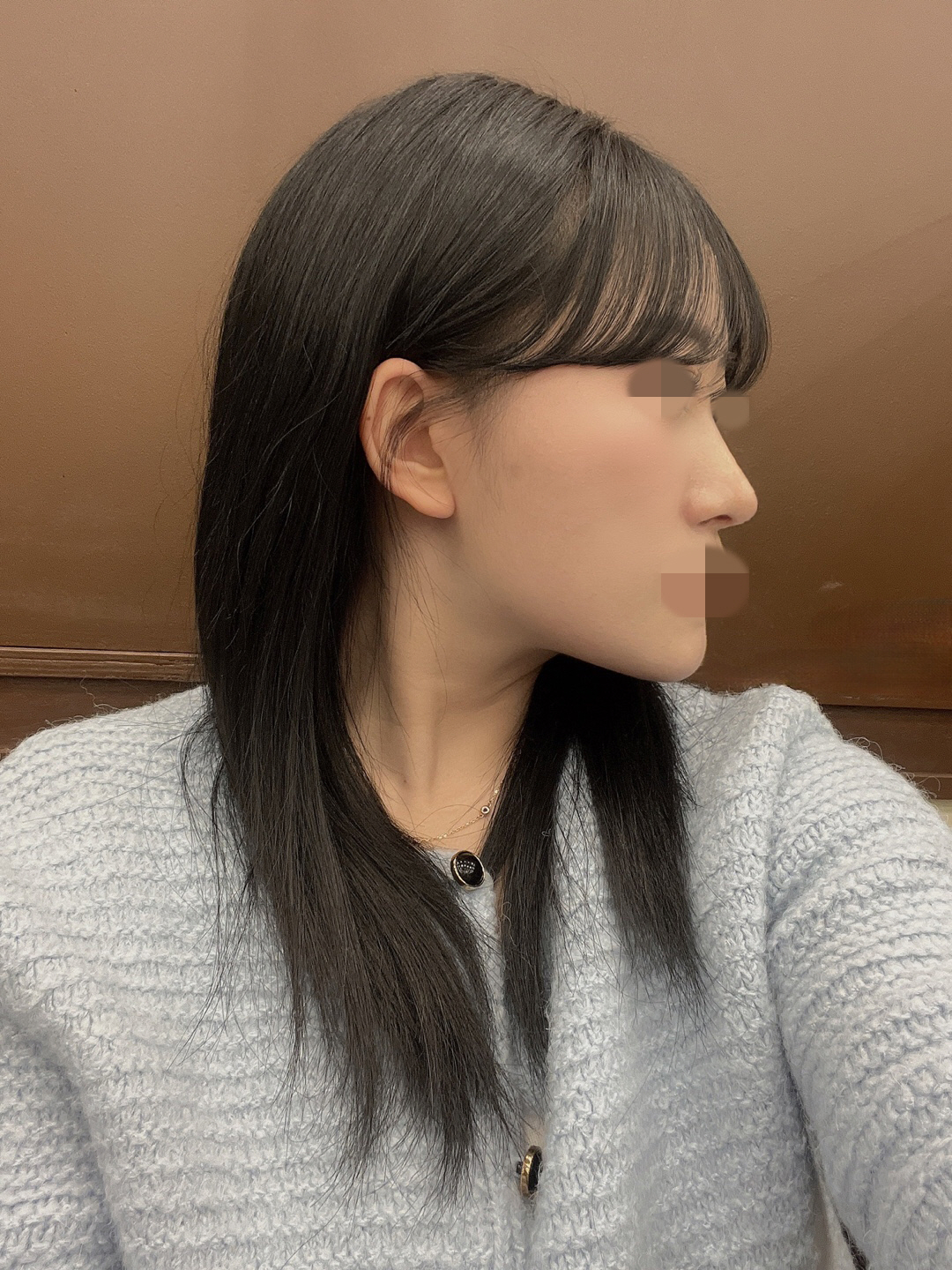 수술후기이미지