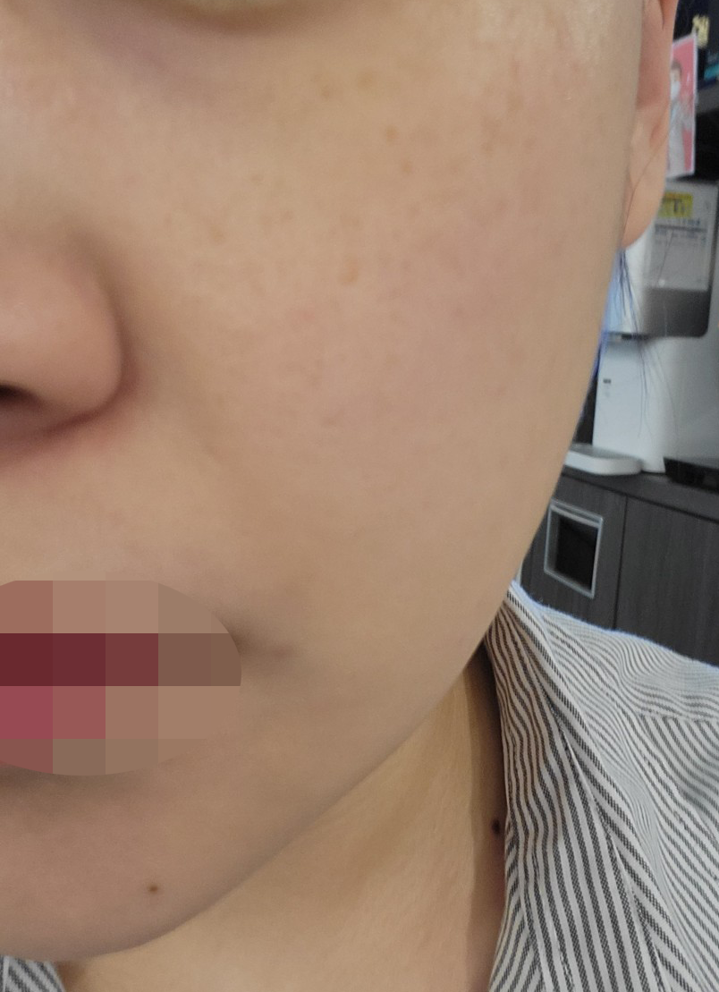수술후기이미지