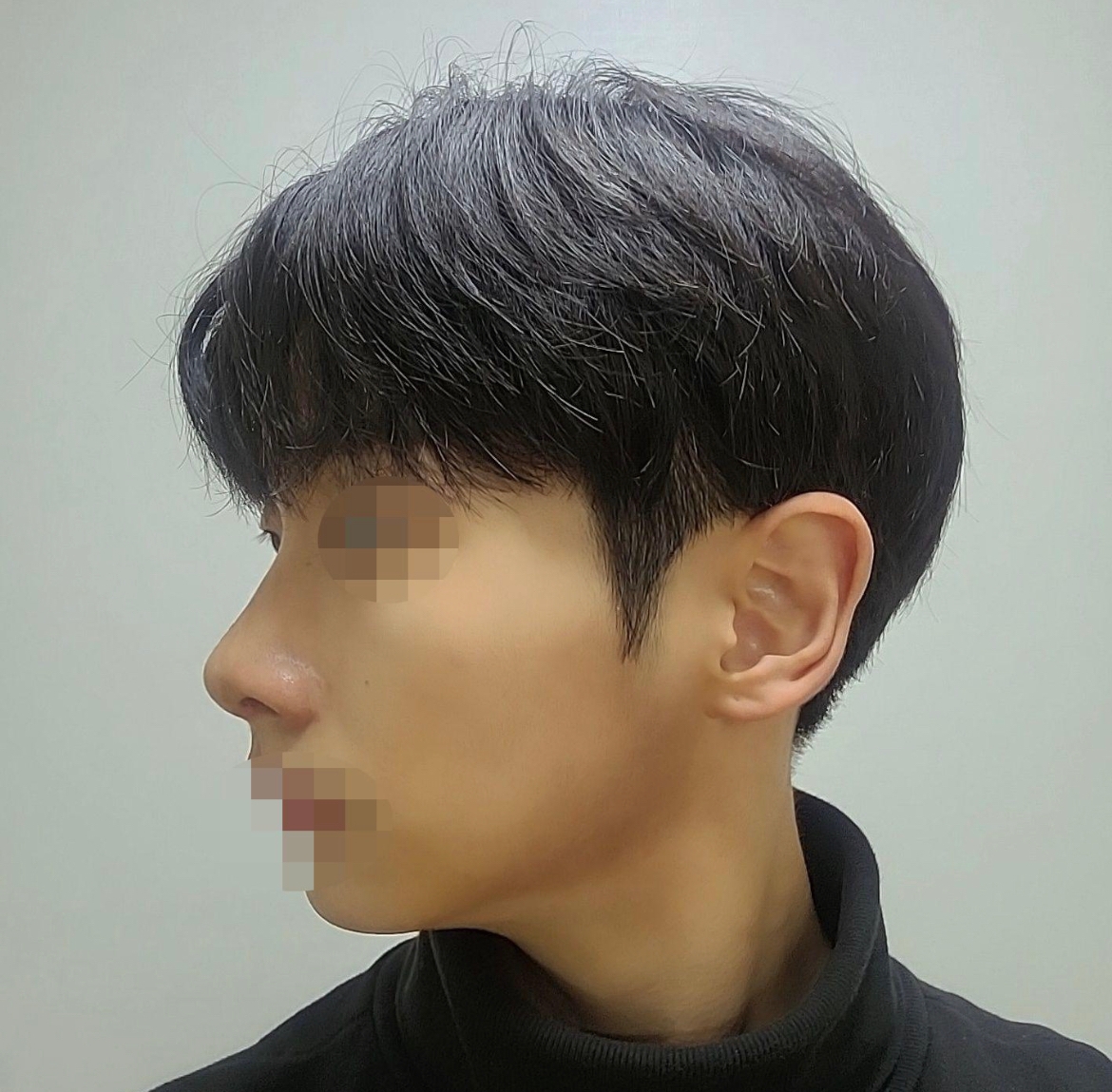 수술후기이미지