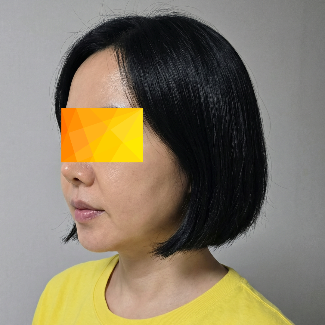 수술후기이미지