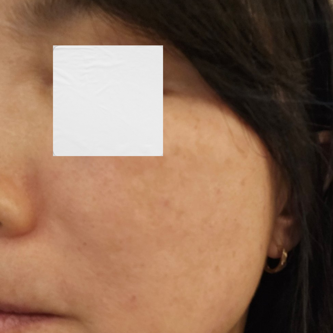 수술후기이미지