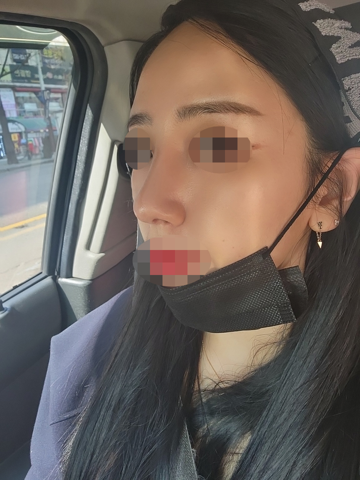 수술후기이미지