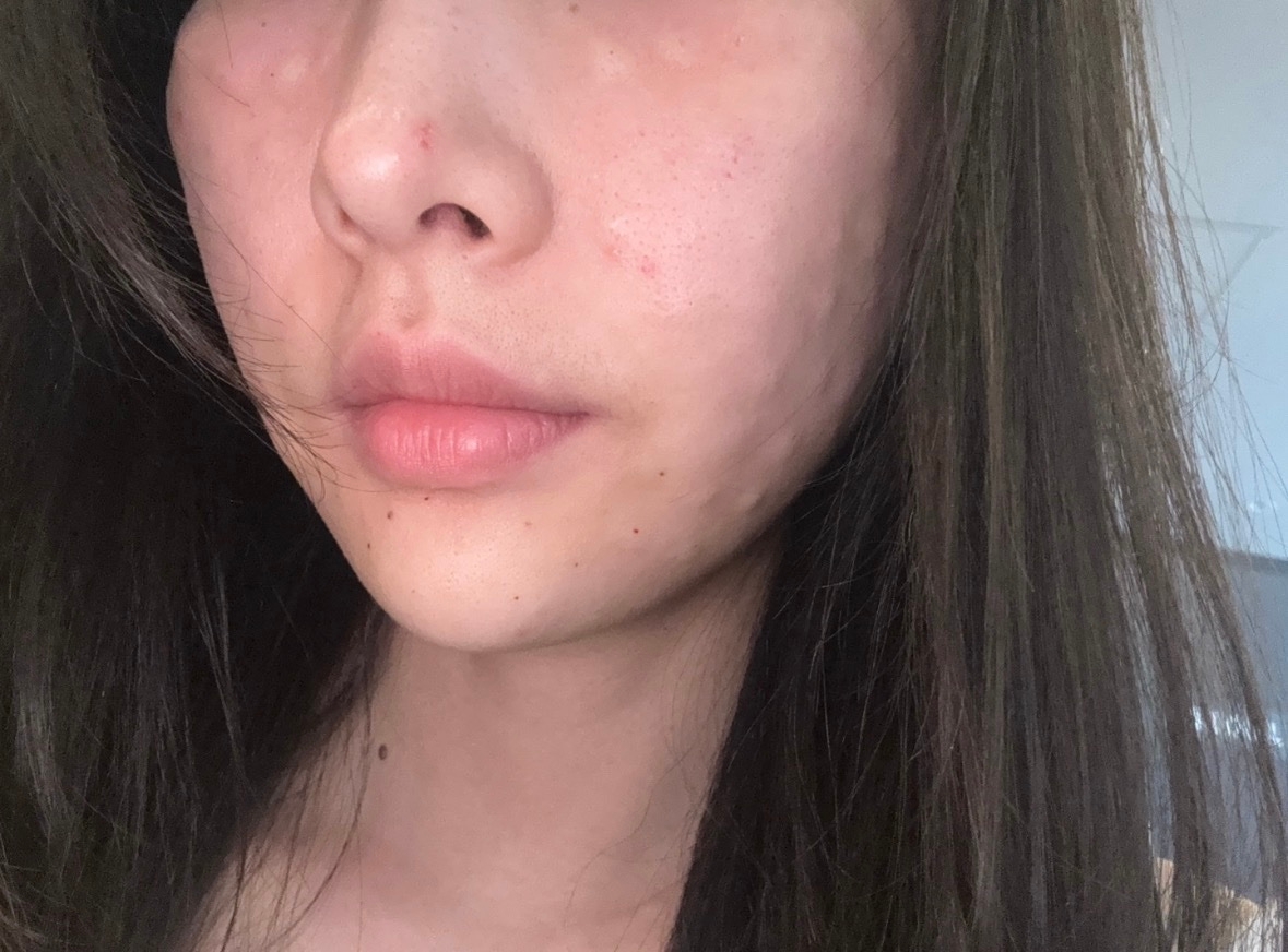 수술후기이미지