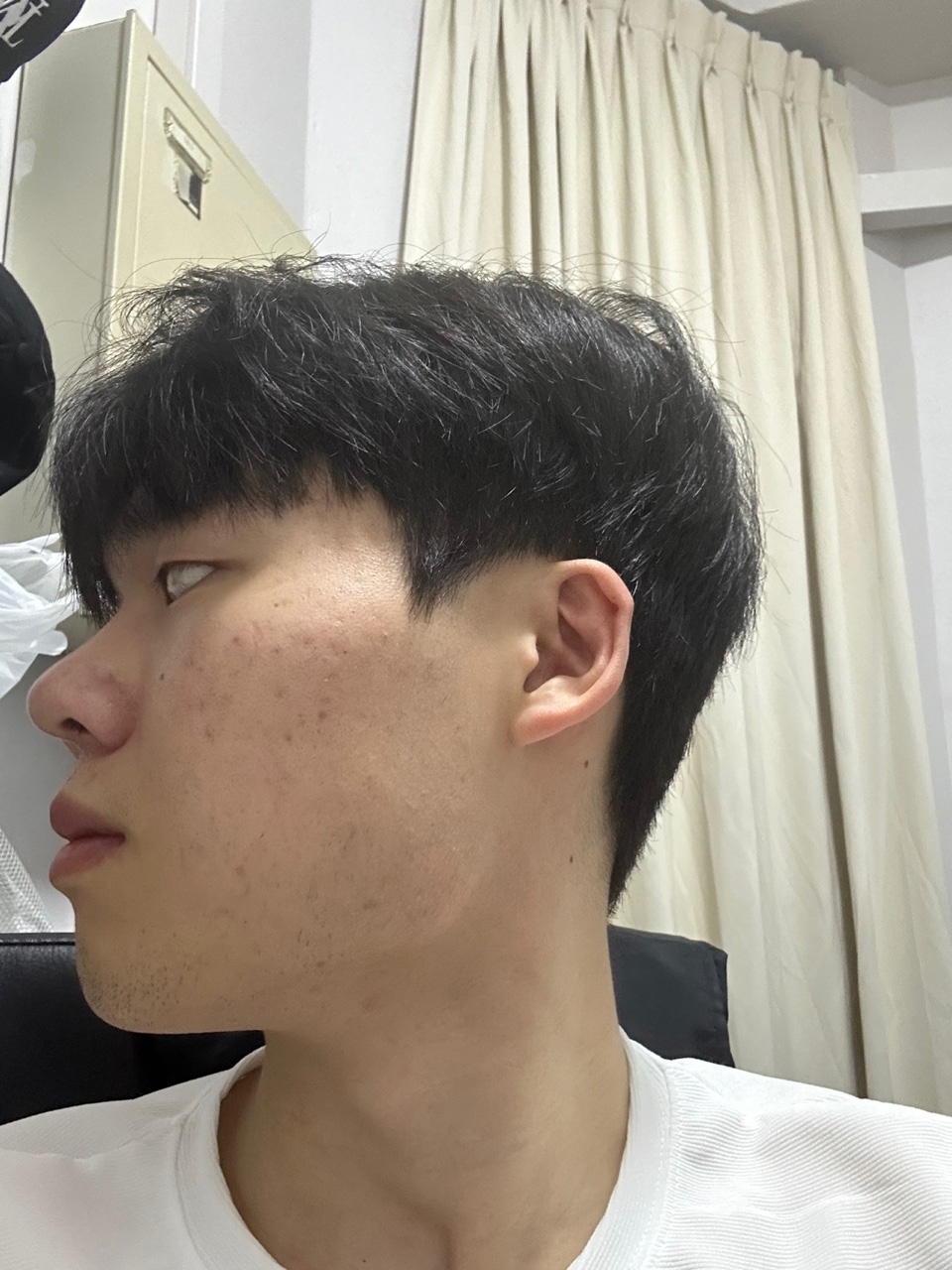 수술후기이미지