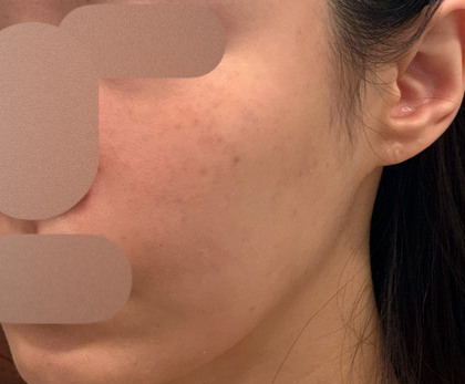 수술후기이미지