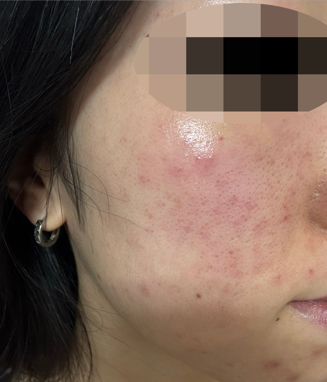 수술후기이미지