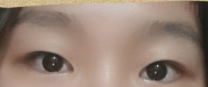 수술후기이미지