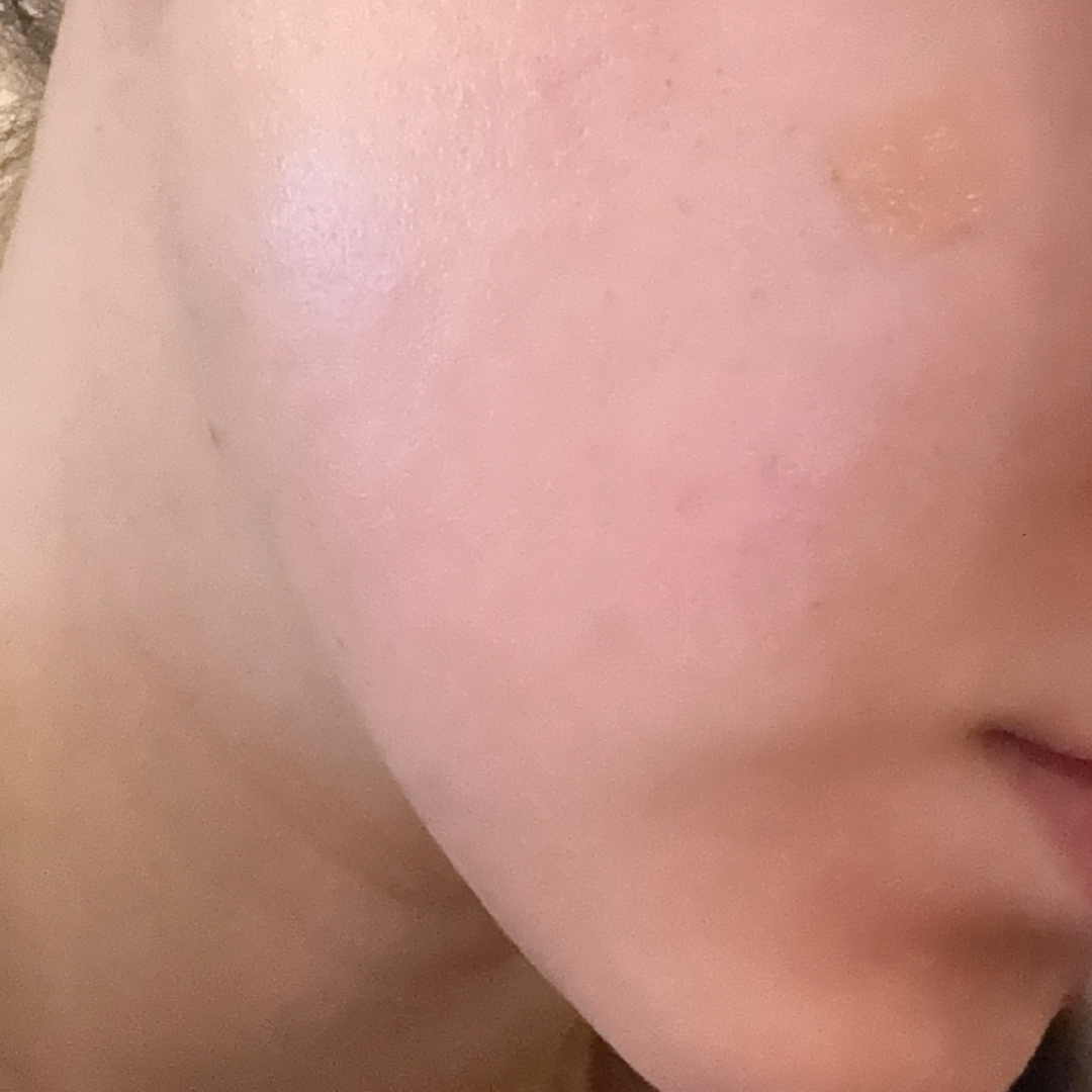 수술후기이미지