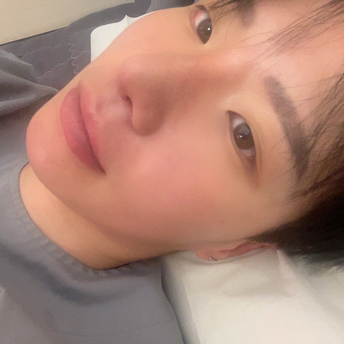 수술후기이미지