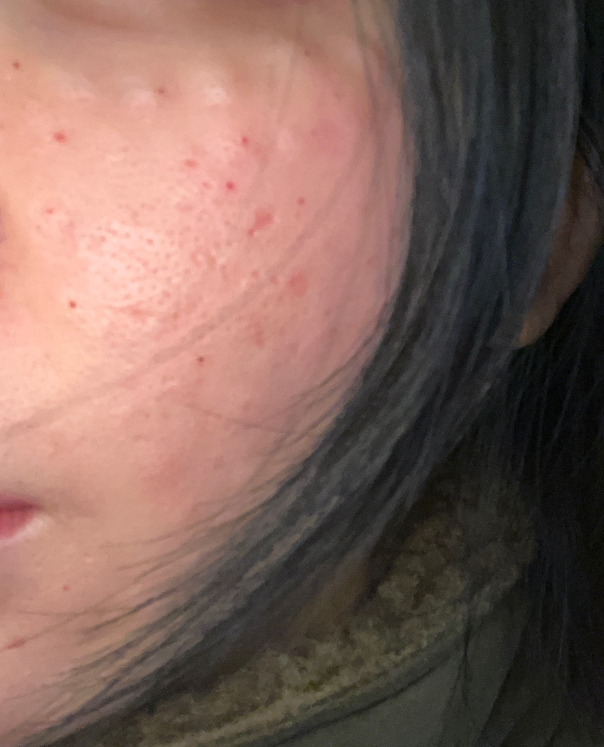 수술후기이미지