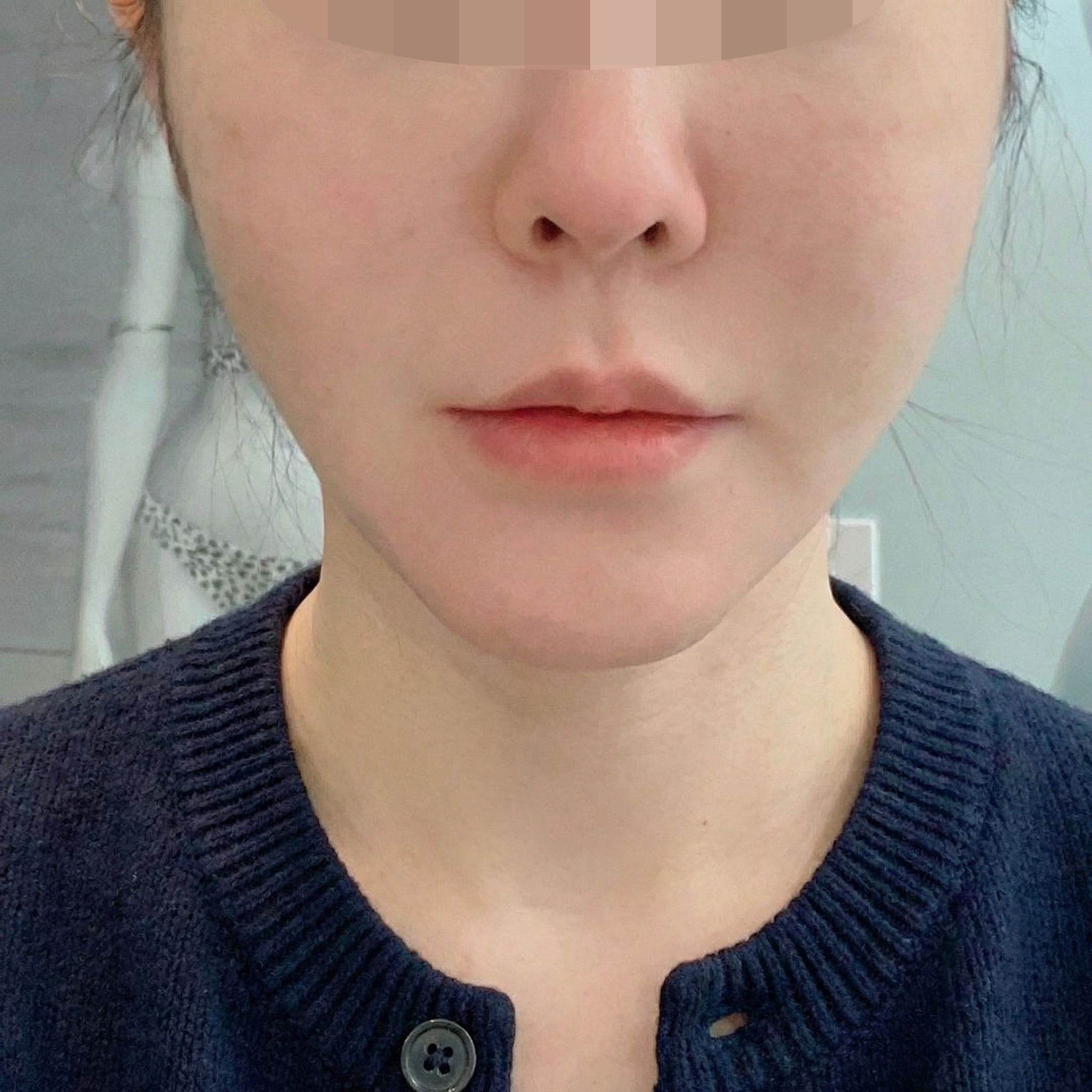 수술후기이미지