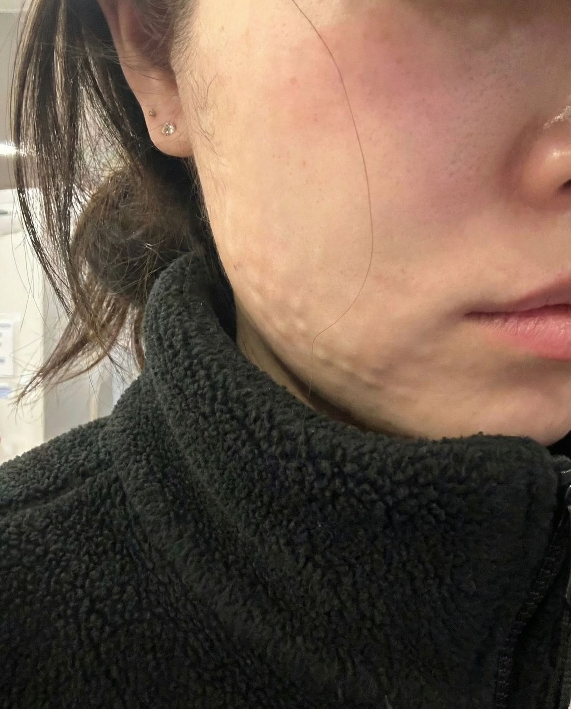 수술후기이미지