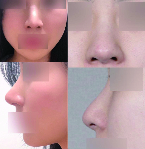 수술후기이미지