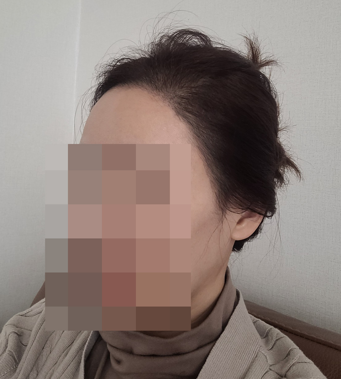 수술후기이미지