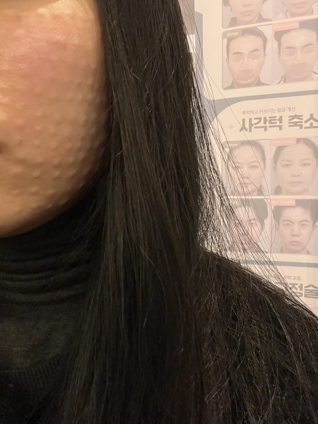 수술후기이미지