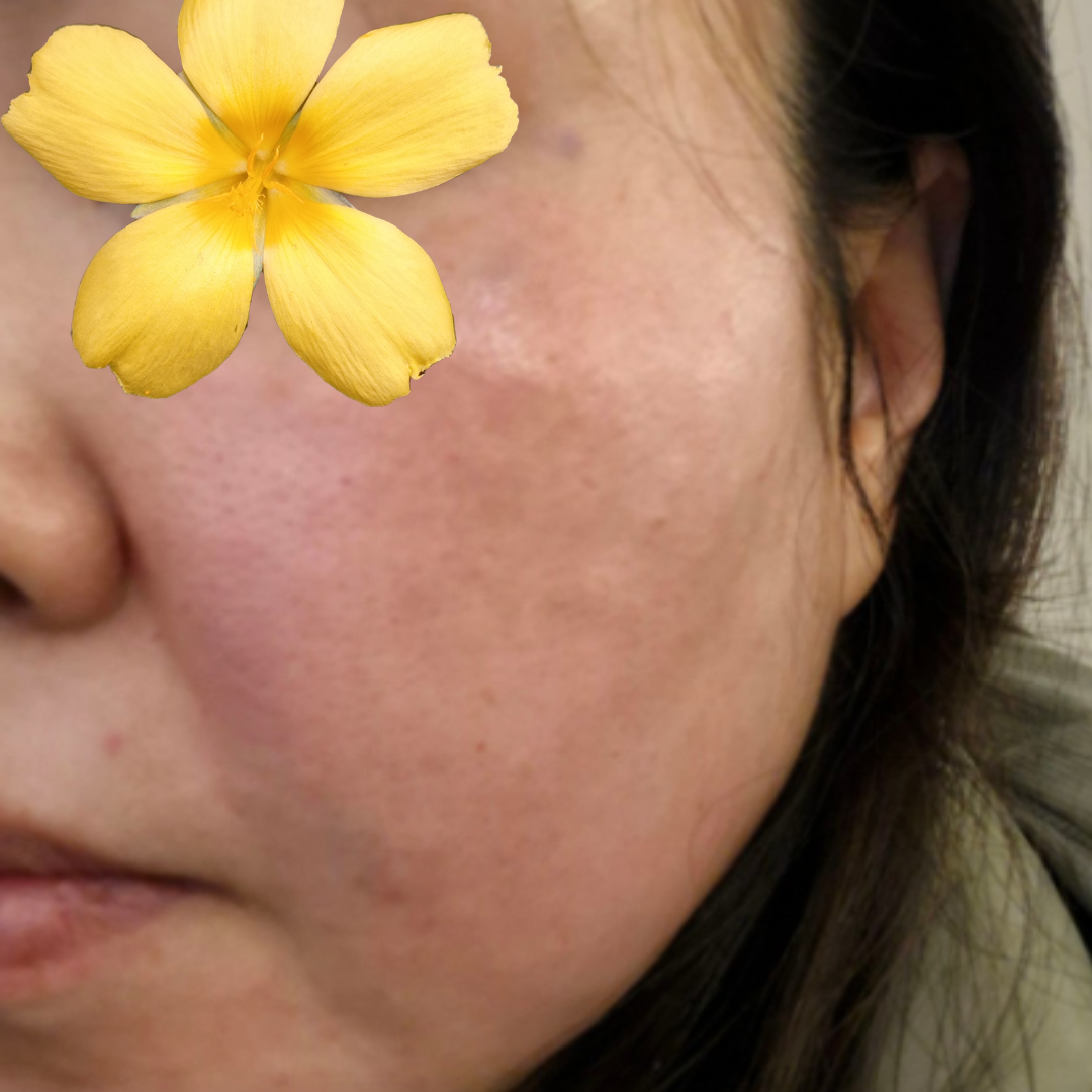 수술후기이미지