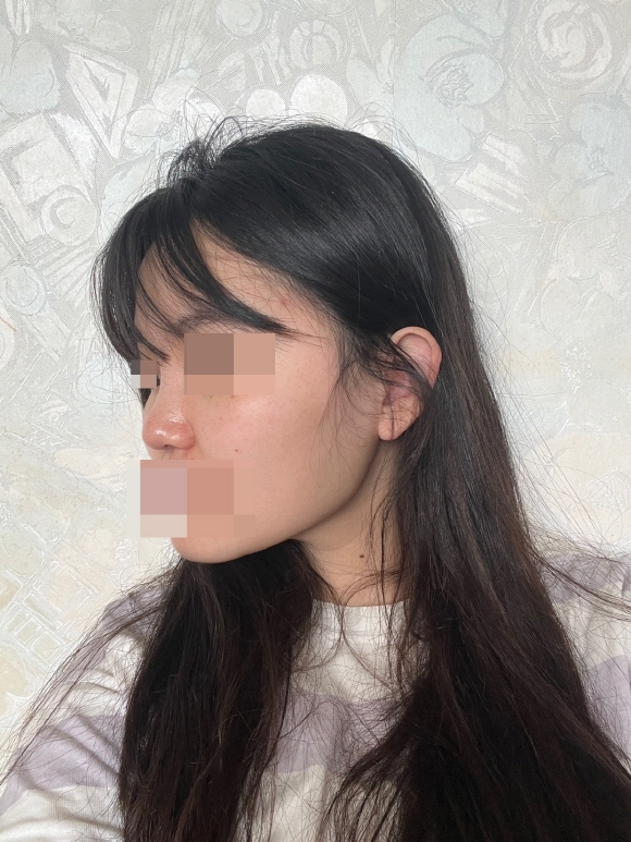 수술후기이미지