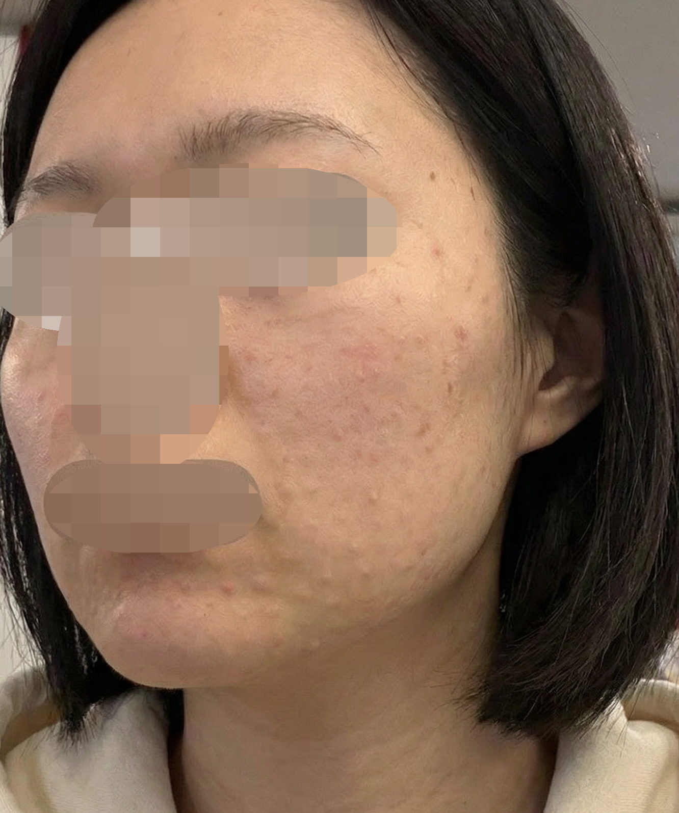 수술후기이미지