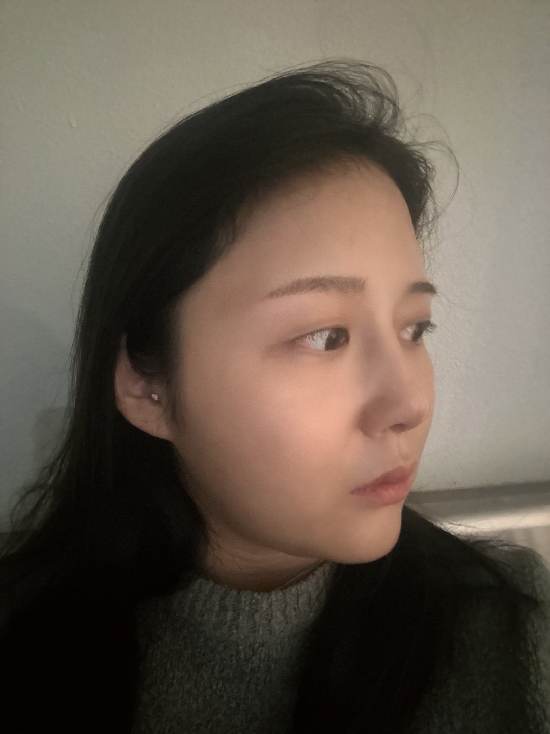 수술후기이미지