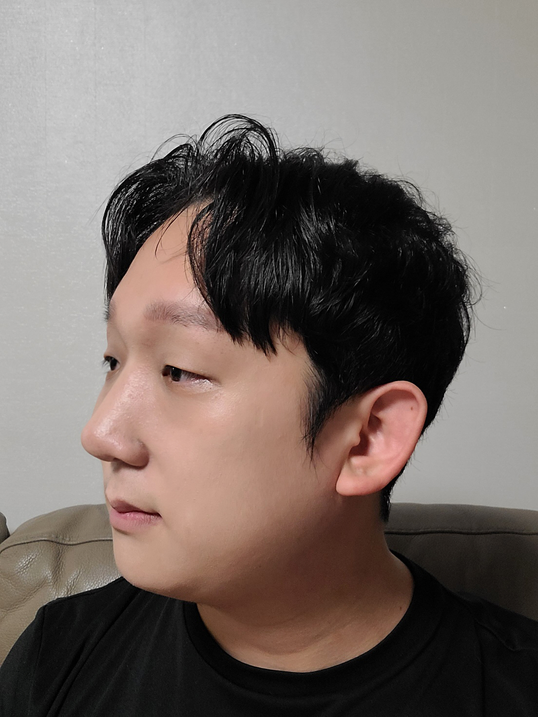 수술후기이미지