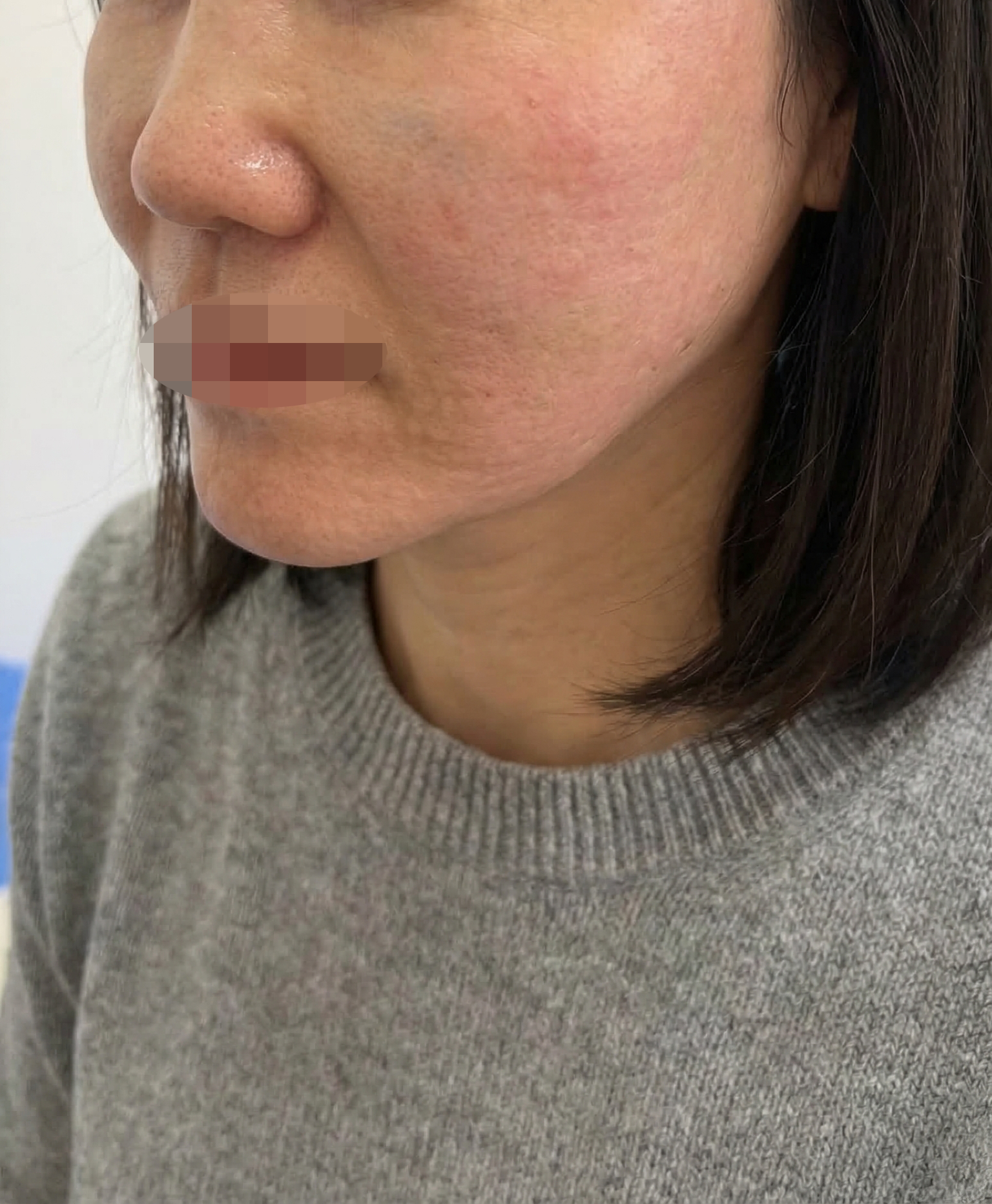 수술후기이미지