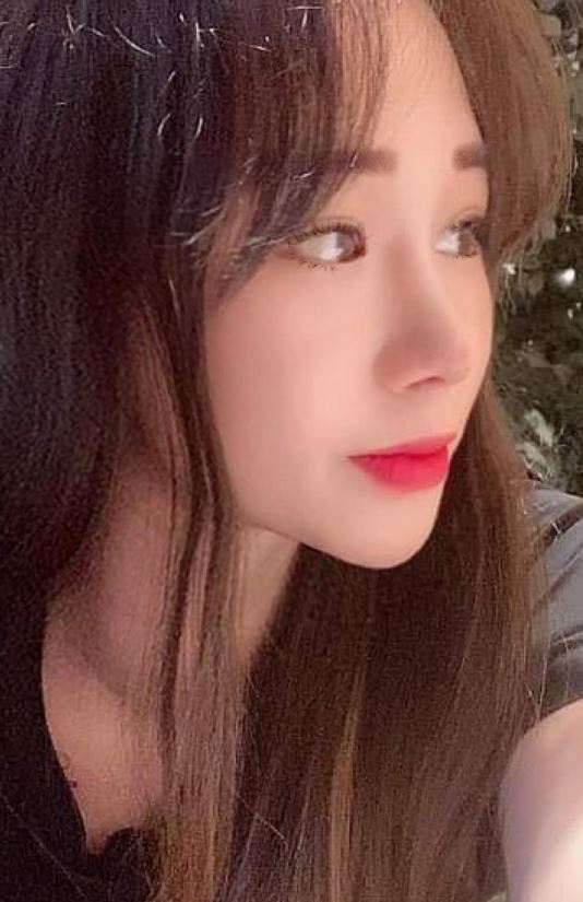 수술후기이미지