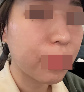 수면마취 덕분에 통증 없이! 한 달에 한 번 꼬박꼬박 올게요