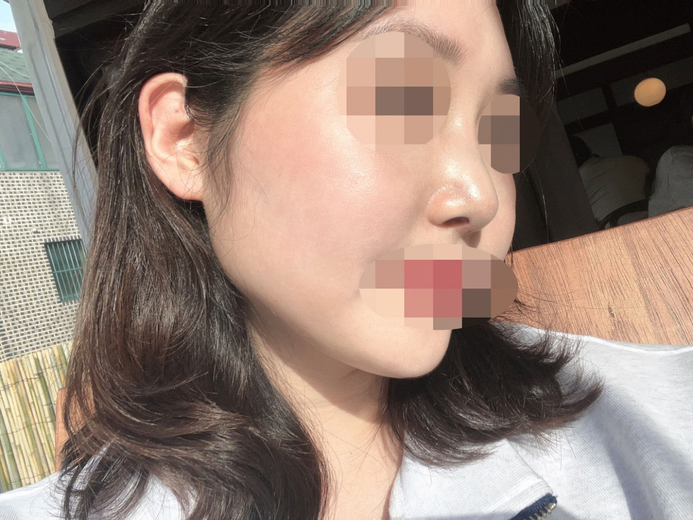 수술후기이미지