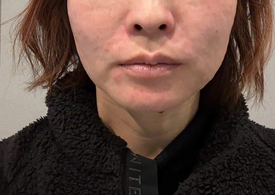 수술후기이미지