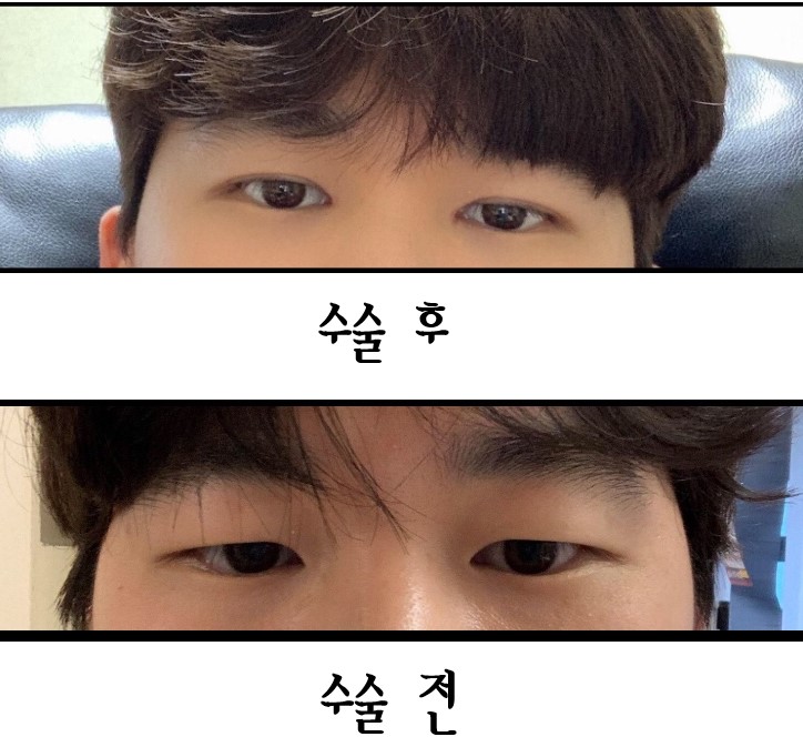 수술후기이미지