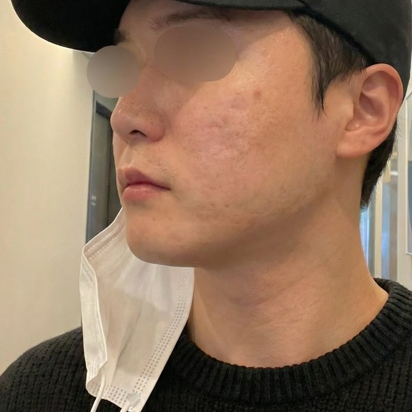 수술후기이미지