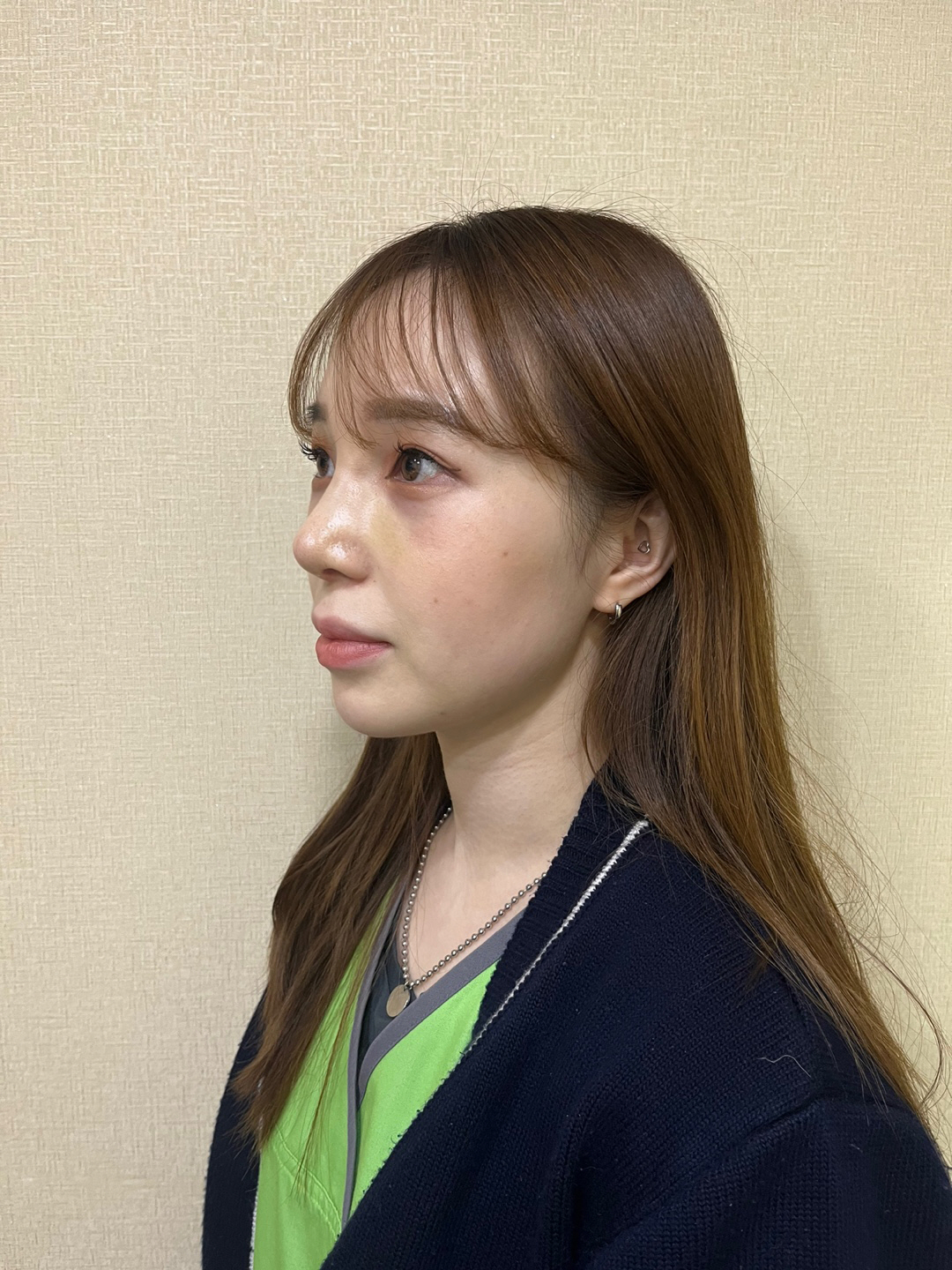 수술후기이미지