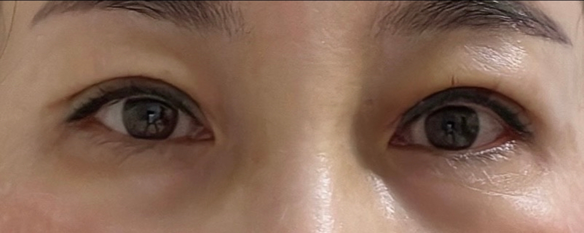 수술후기이미지