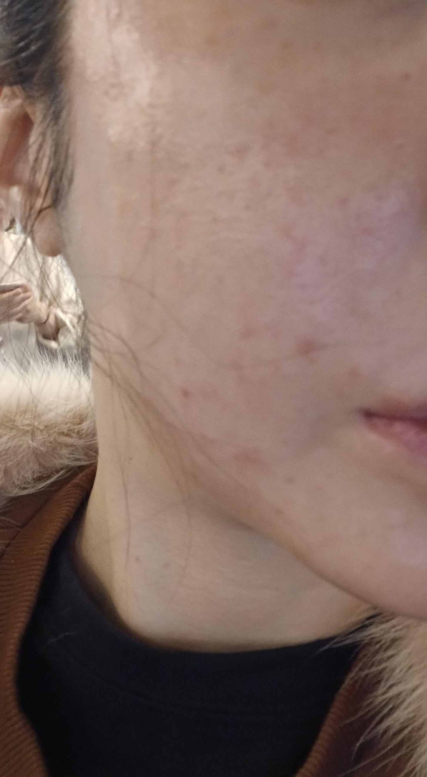 수술후기이미지