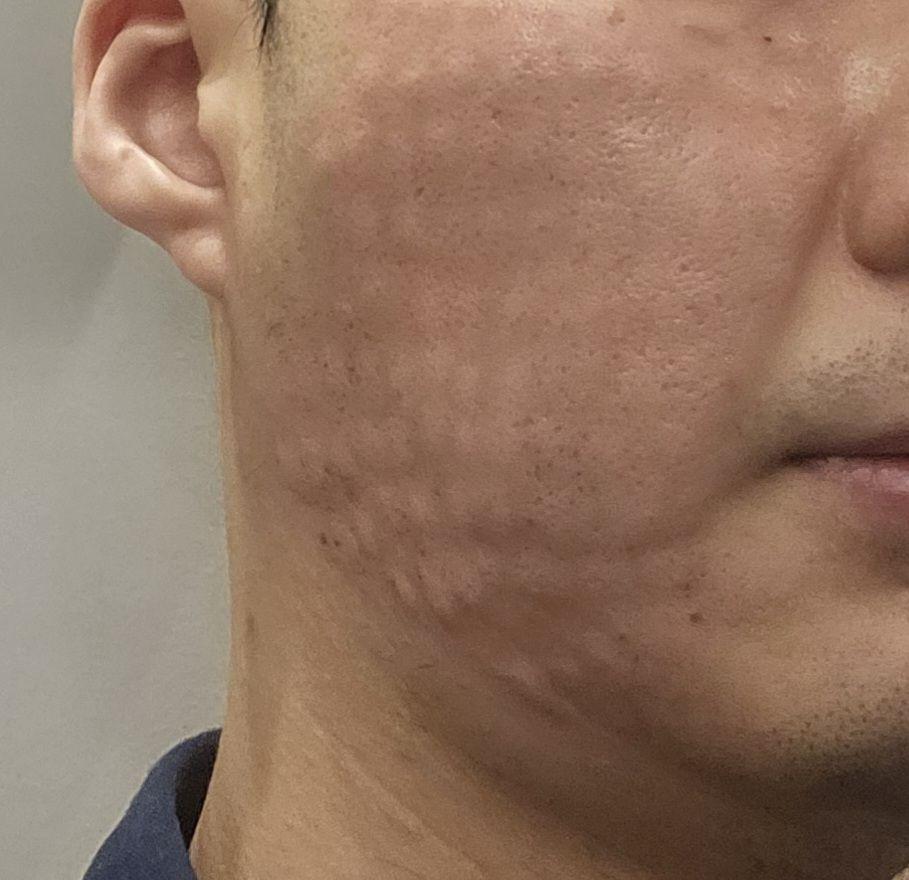 수술후기이미지