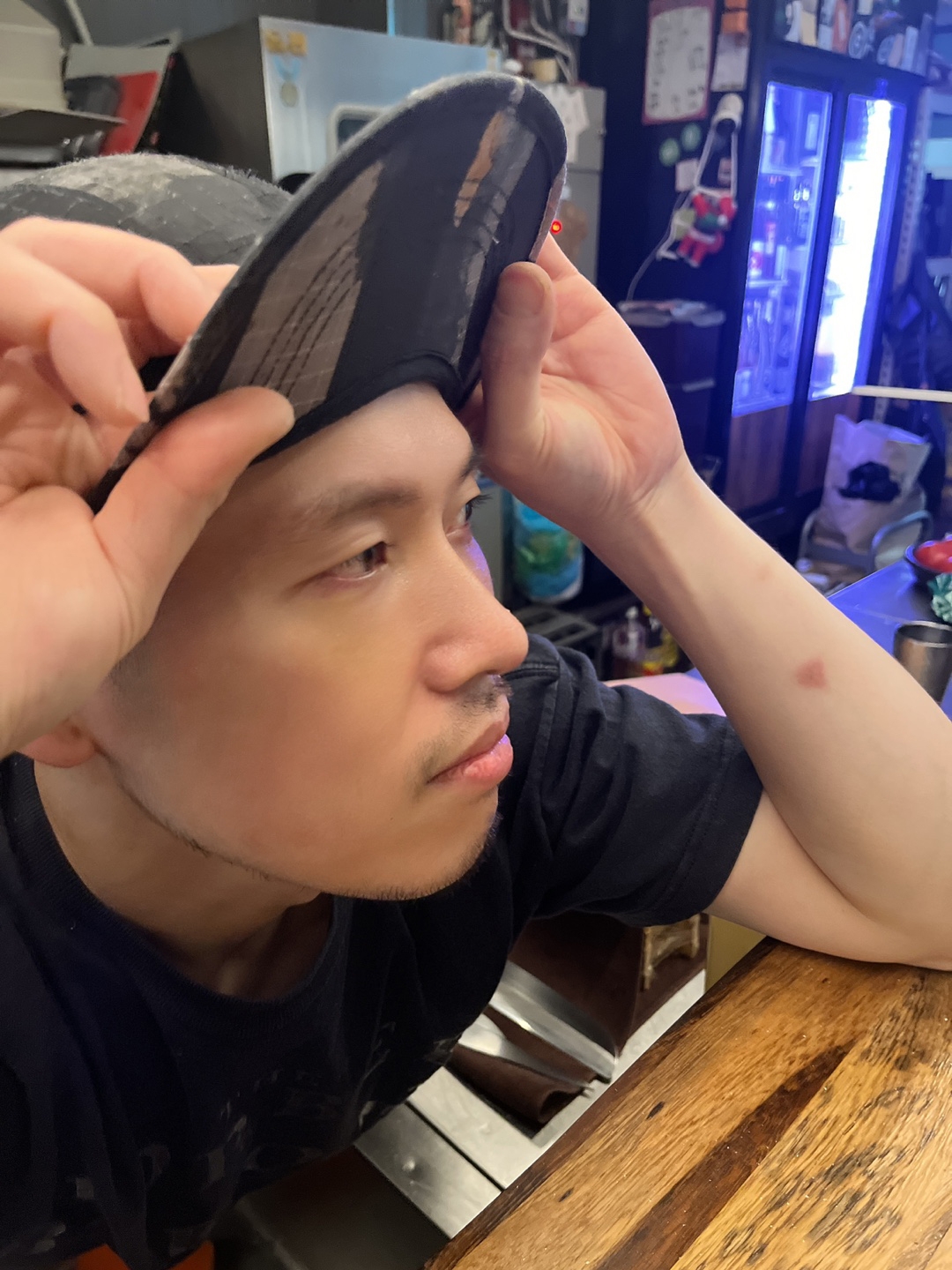 수술후기이미지