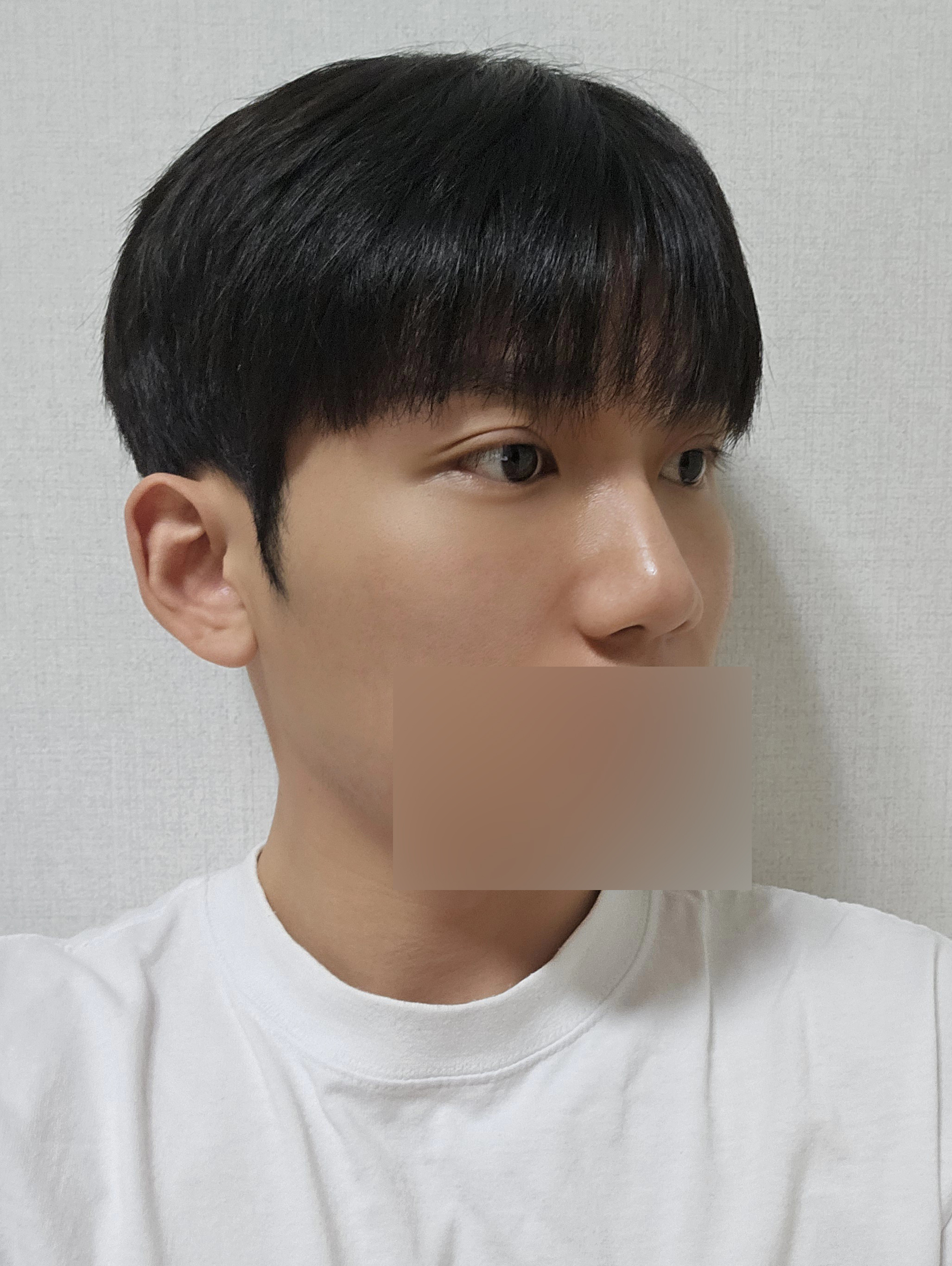 수술후기이미지