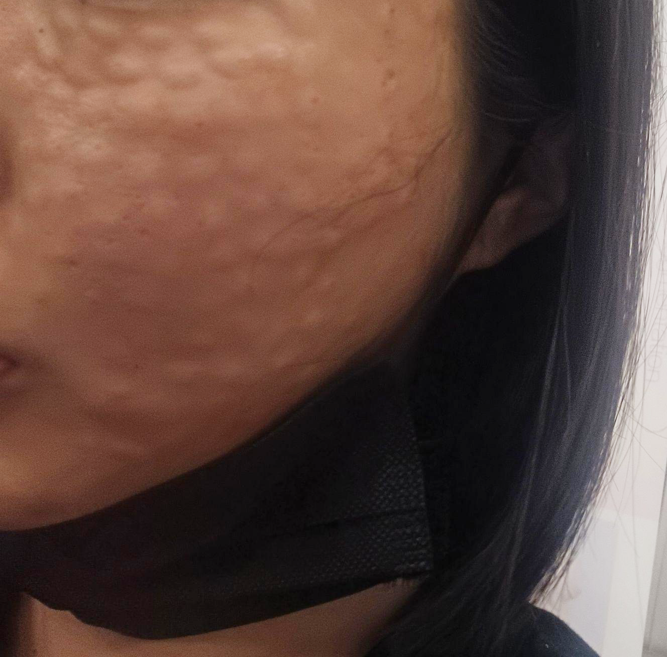 수술후기이미지