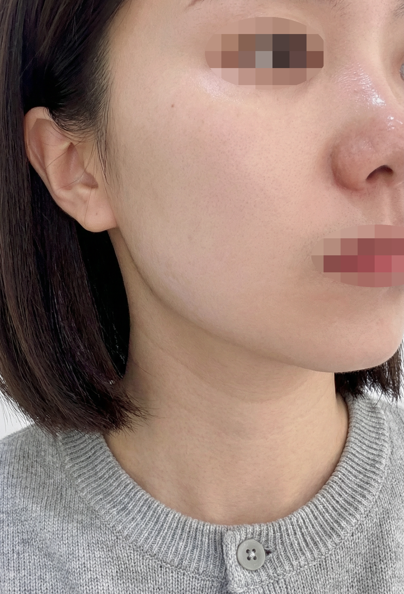 수술후기이미지