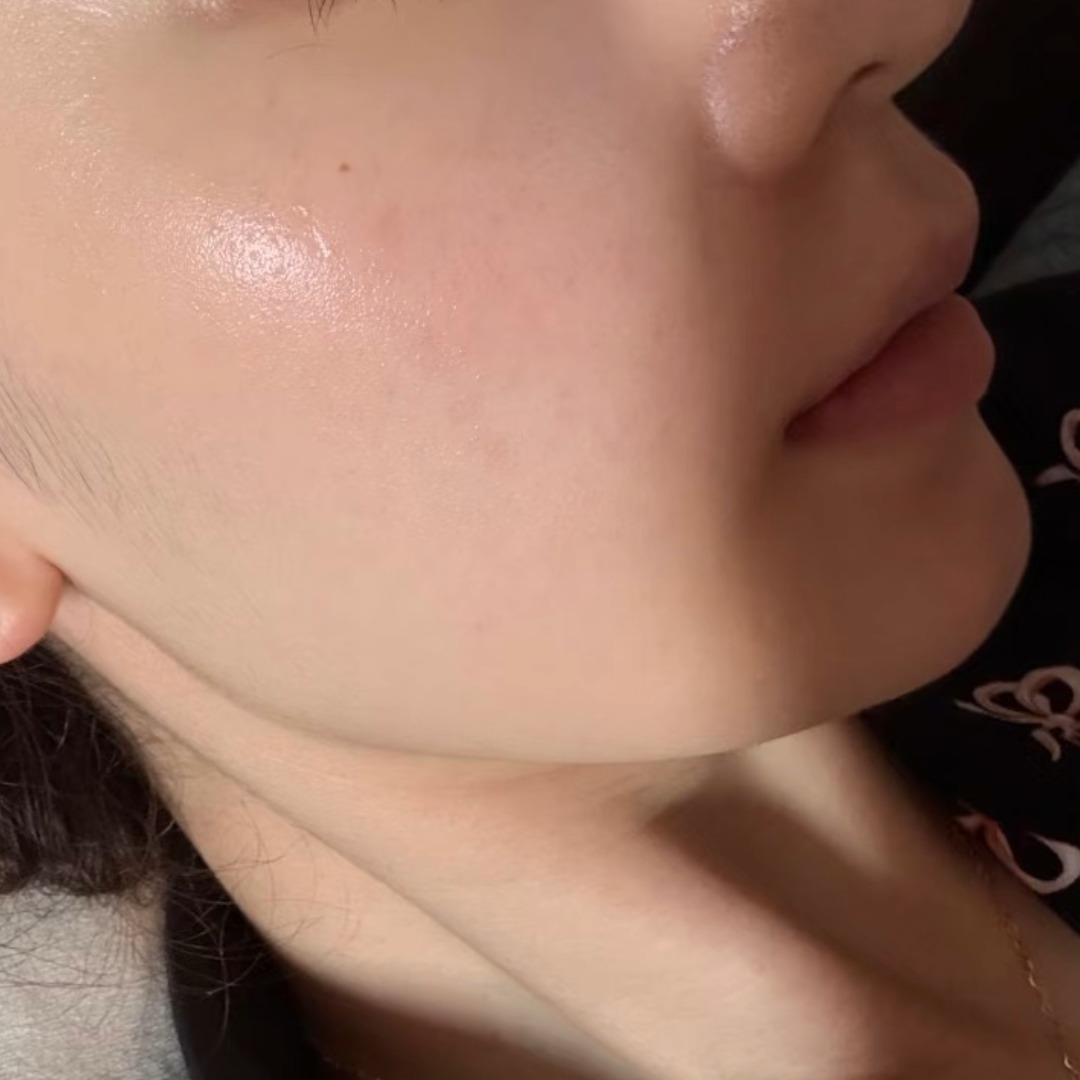 수술후기이미지