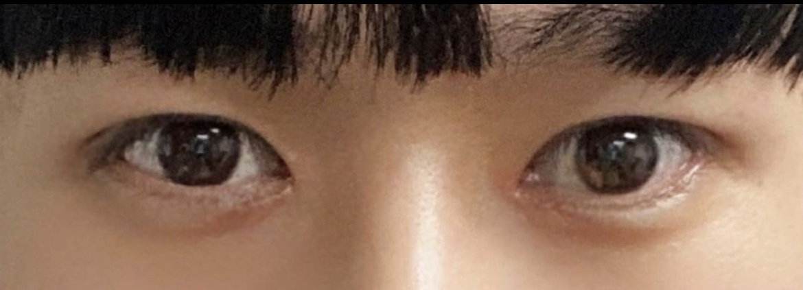 수술후기이미지