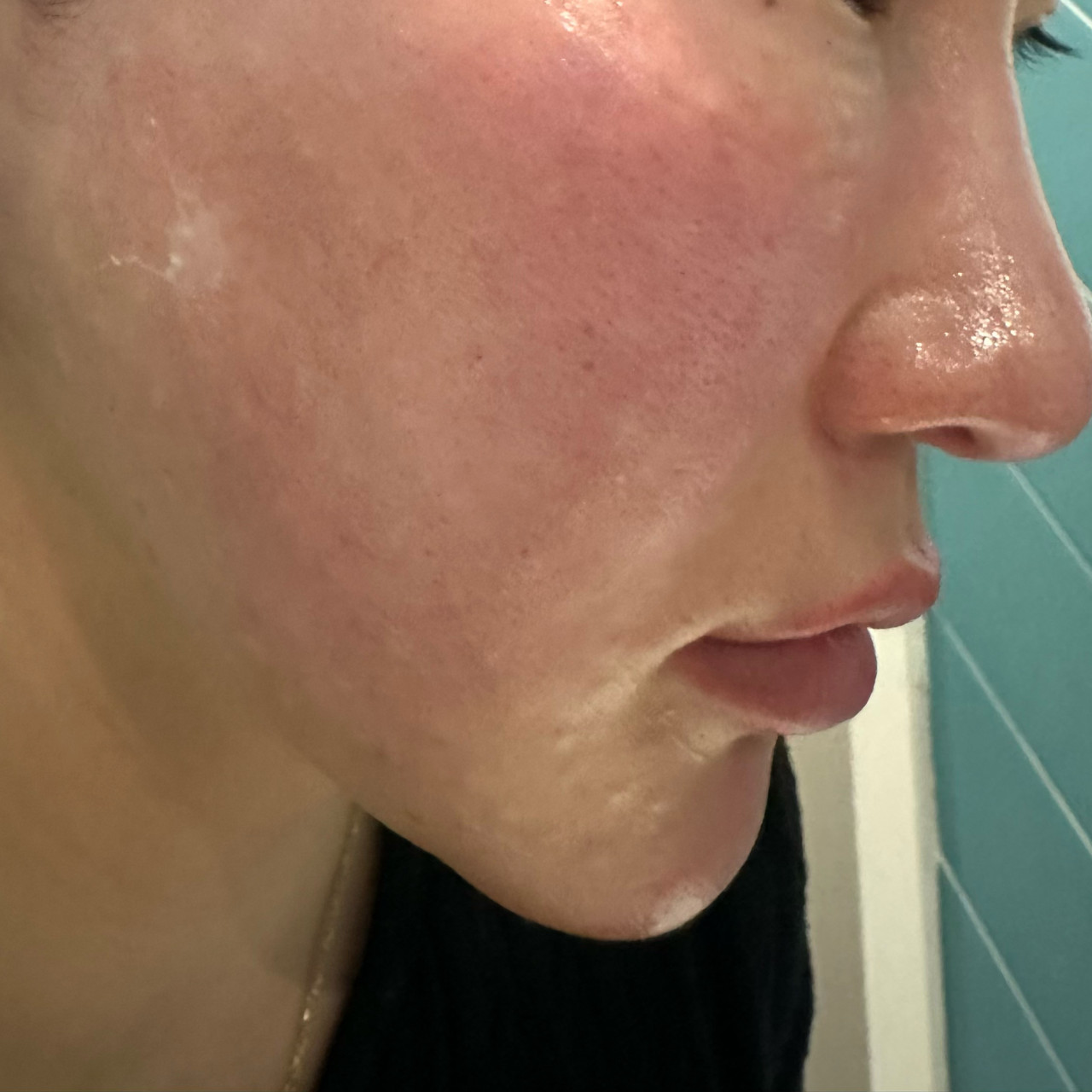 수술후기이미지