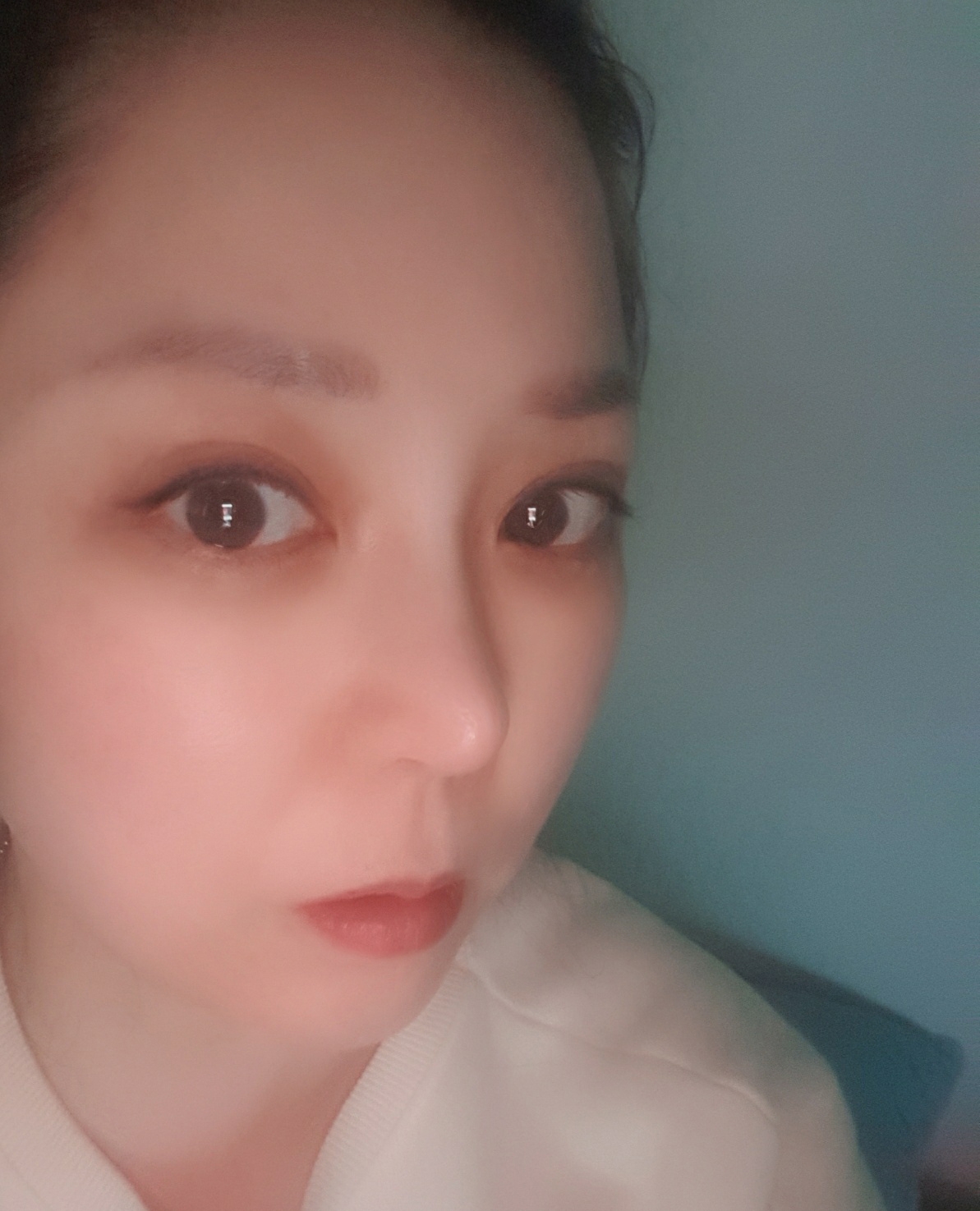 수술후기이미지