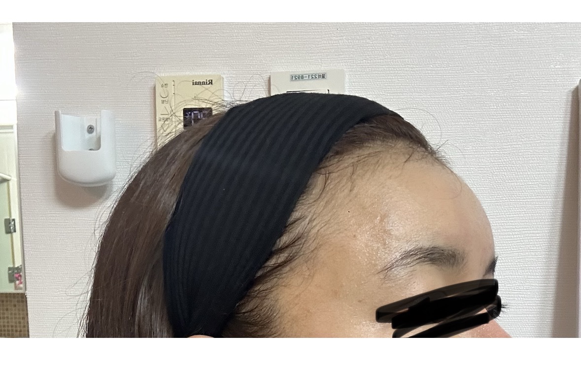 수술후기이미지