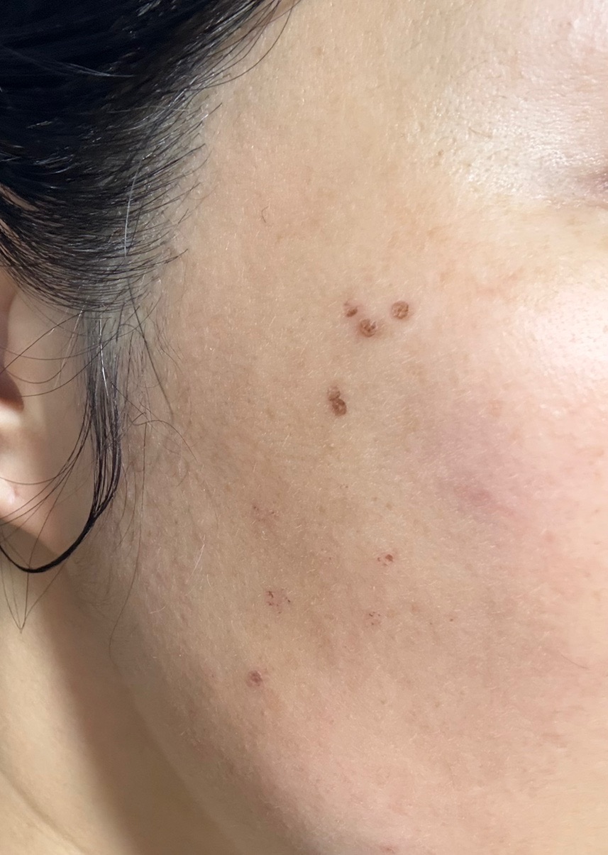 수술후기이미지