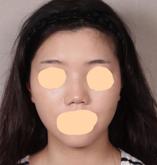 수술후기이미지