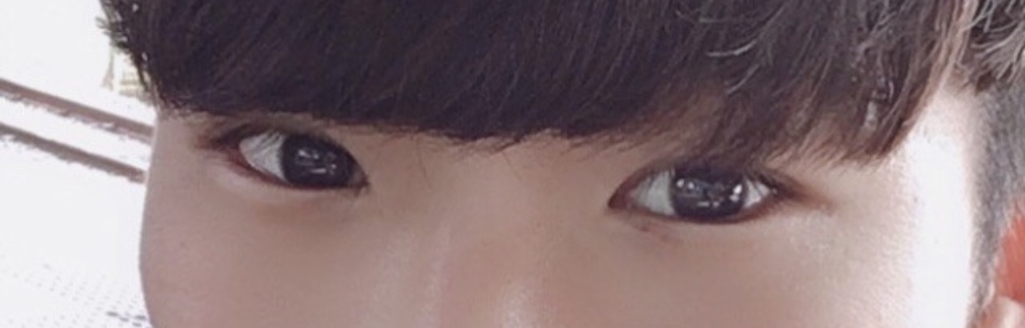 수술후기이미지