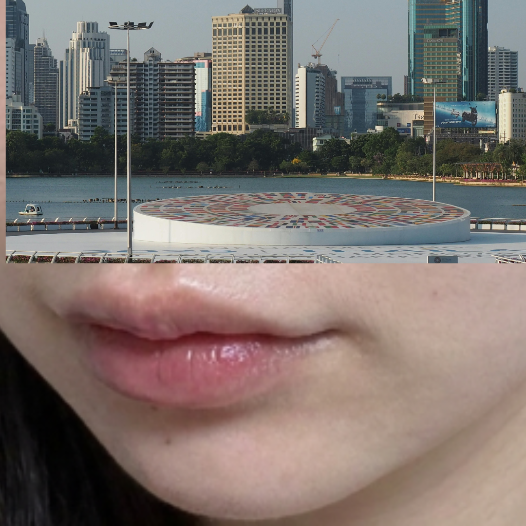 수술후기이미지
