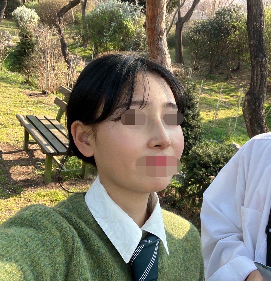 수술후기이미지